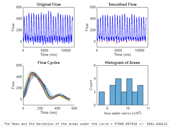 Processed MRI Blood Flow Data Output